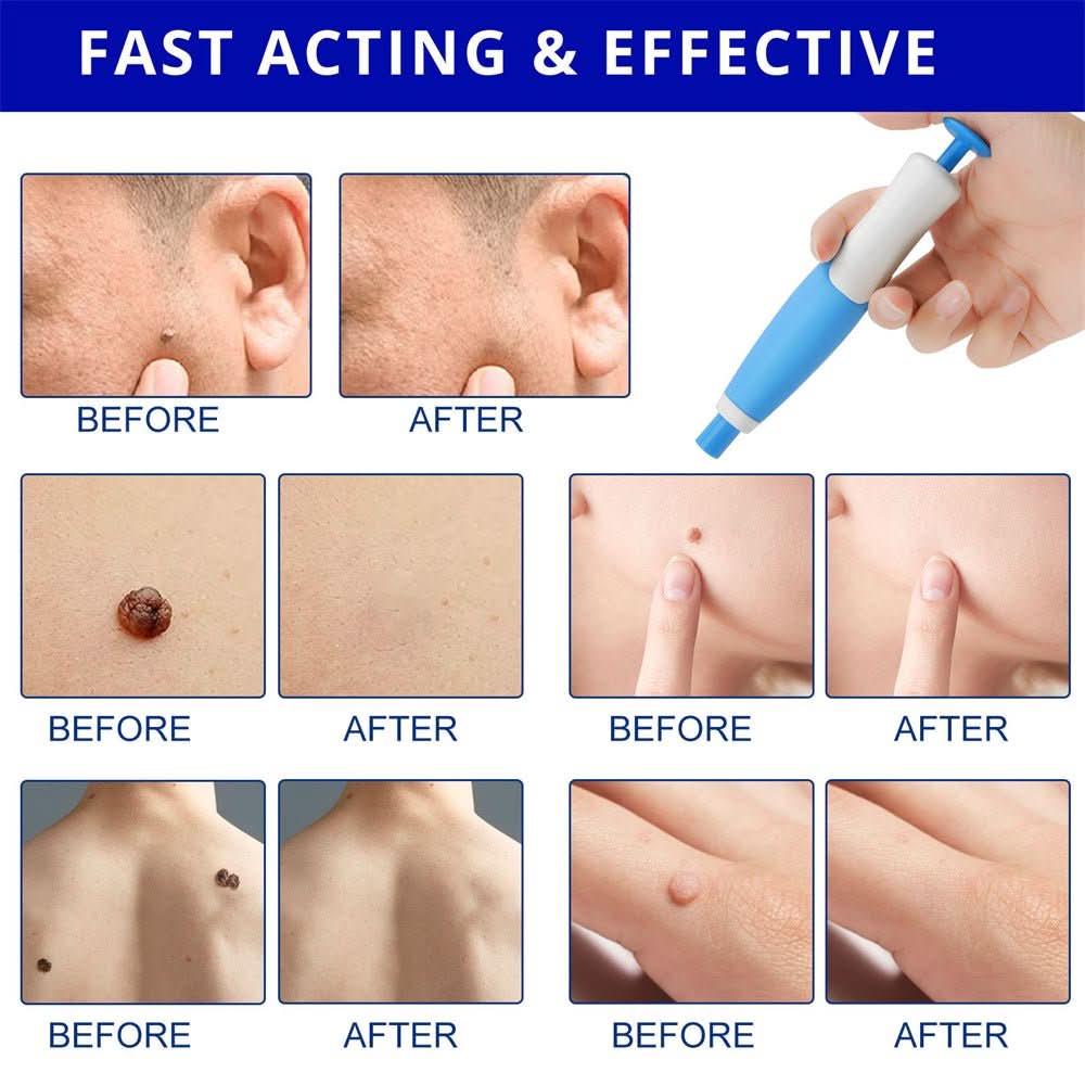 Pelvifit Stylo Correcteur de Taches Cutanées Ciblé