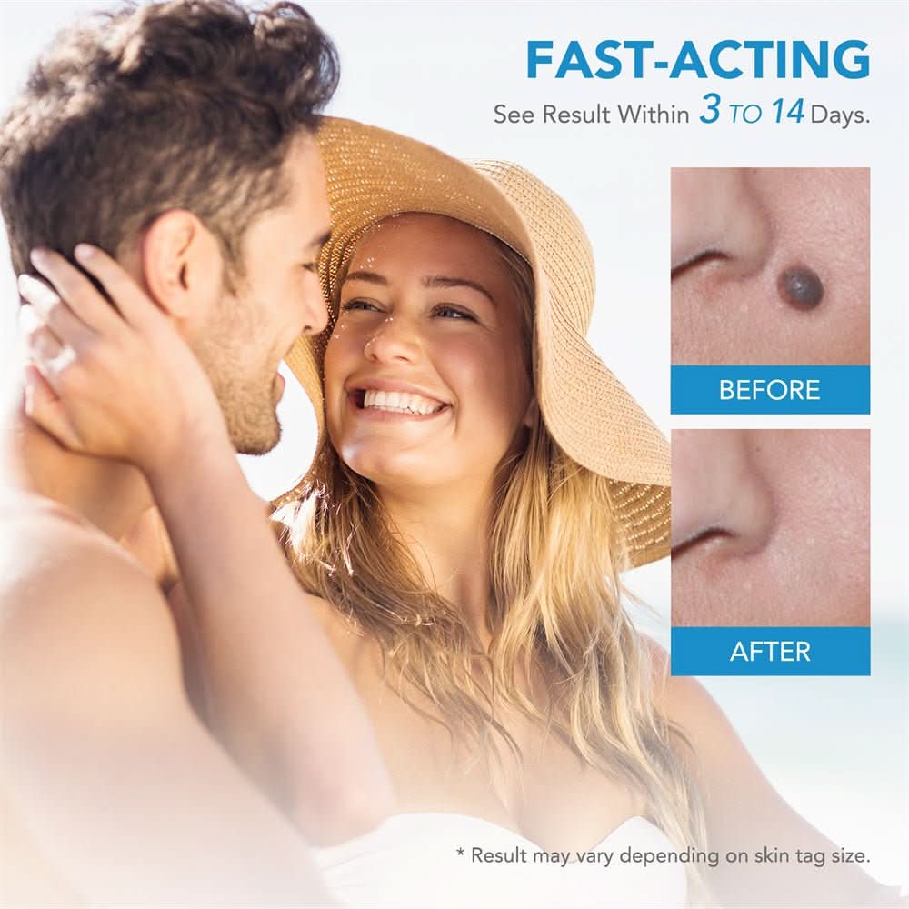 Pelvifit Stylo Correcteur de Taches Cutanées Ciblé