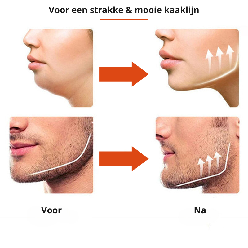 FaceTone Sculpt - Entraîneur de Mâchoire en Silicone