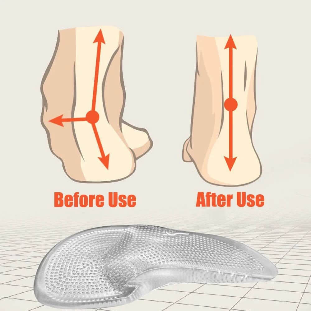 Solafix Semelles Gel Orthopédiques Confort Plantaire