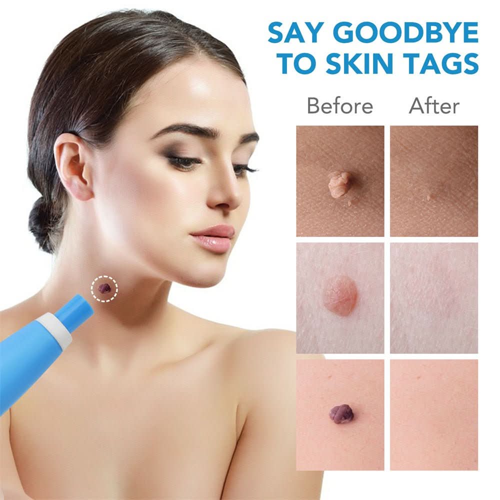 Pelvifit Stylo Correcteur de Taches Cutanées Ciblé