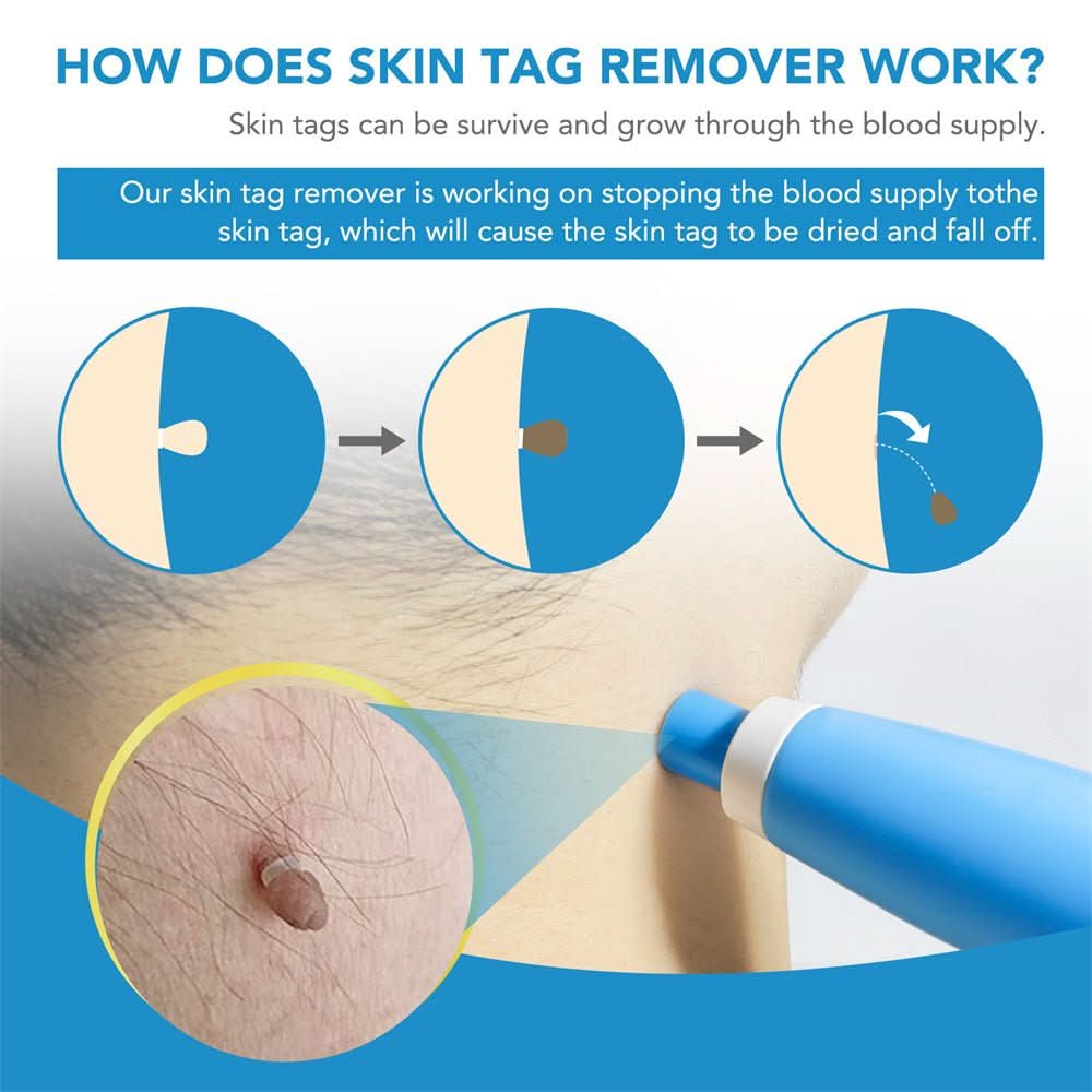 Pelvifit Stylo Correcteur de Taches Cutanées Ciblé