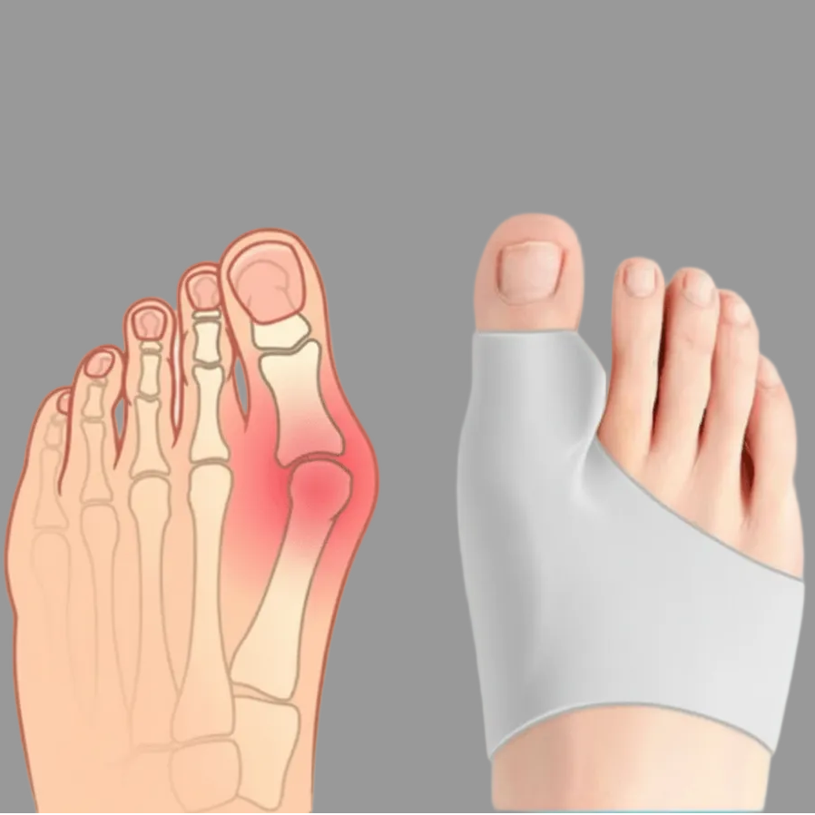Alignflex Hallux Valgus Corrector for Teens